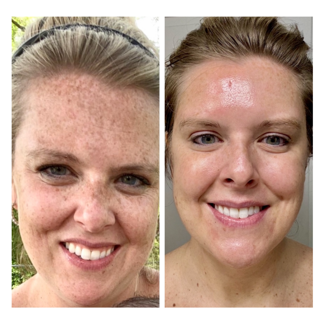 Medspa in Mars, PA 16046 l Aesthetics Radiance Medical Spa (2).png