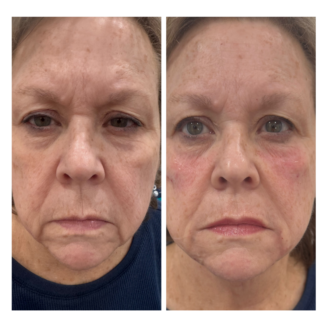 Medspa in Mars, PA 16046 l Aesthetics Radiance Medical Spa.png