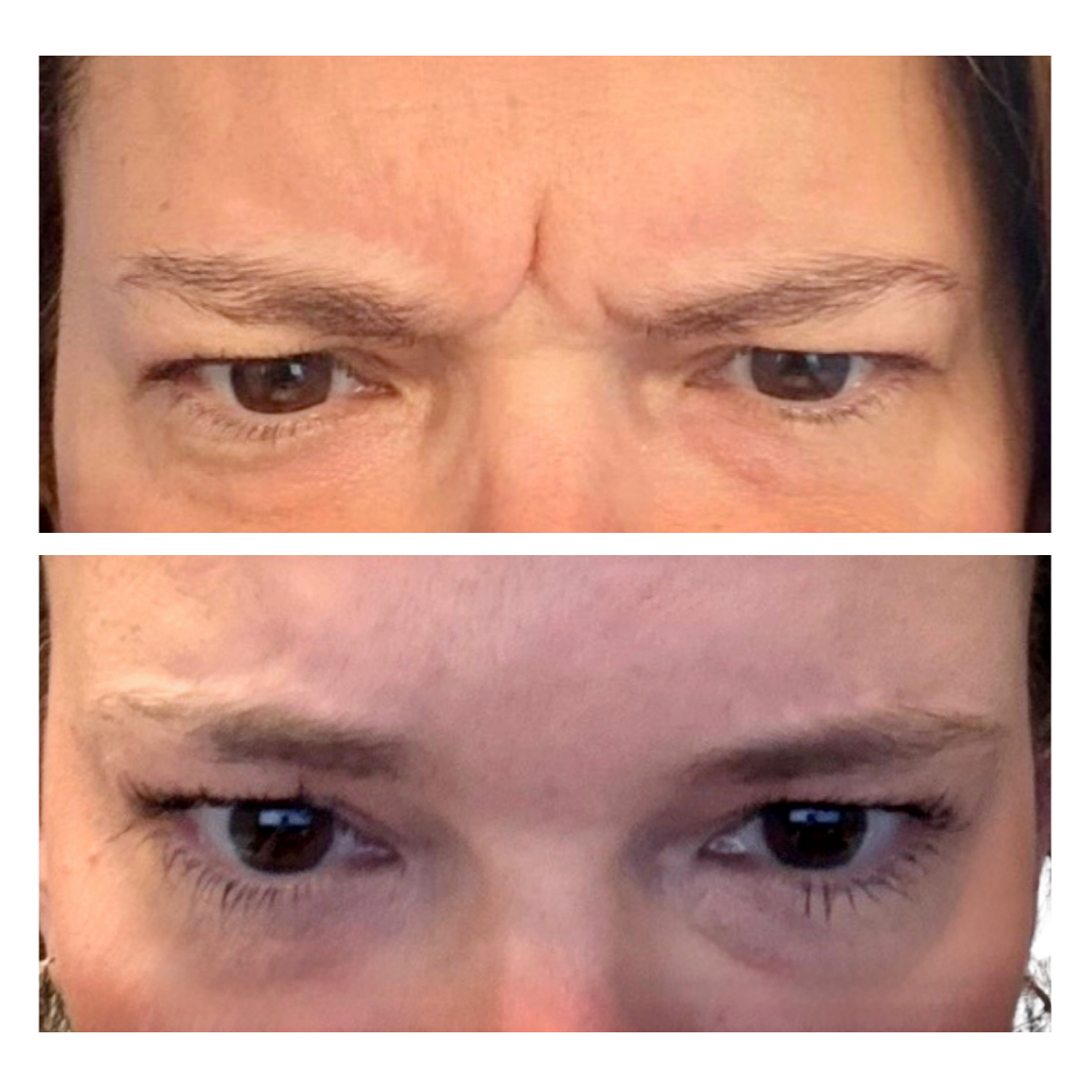 Medspa in Mars, PA 16046 l Aesthetics Radiance Medical Spa (4).png