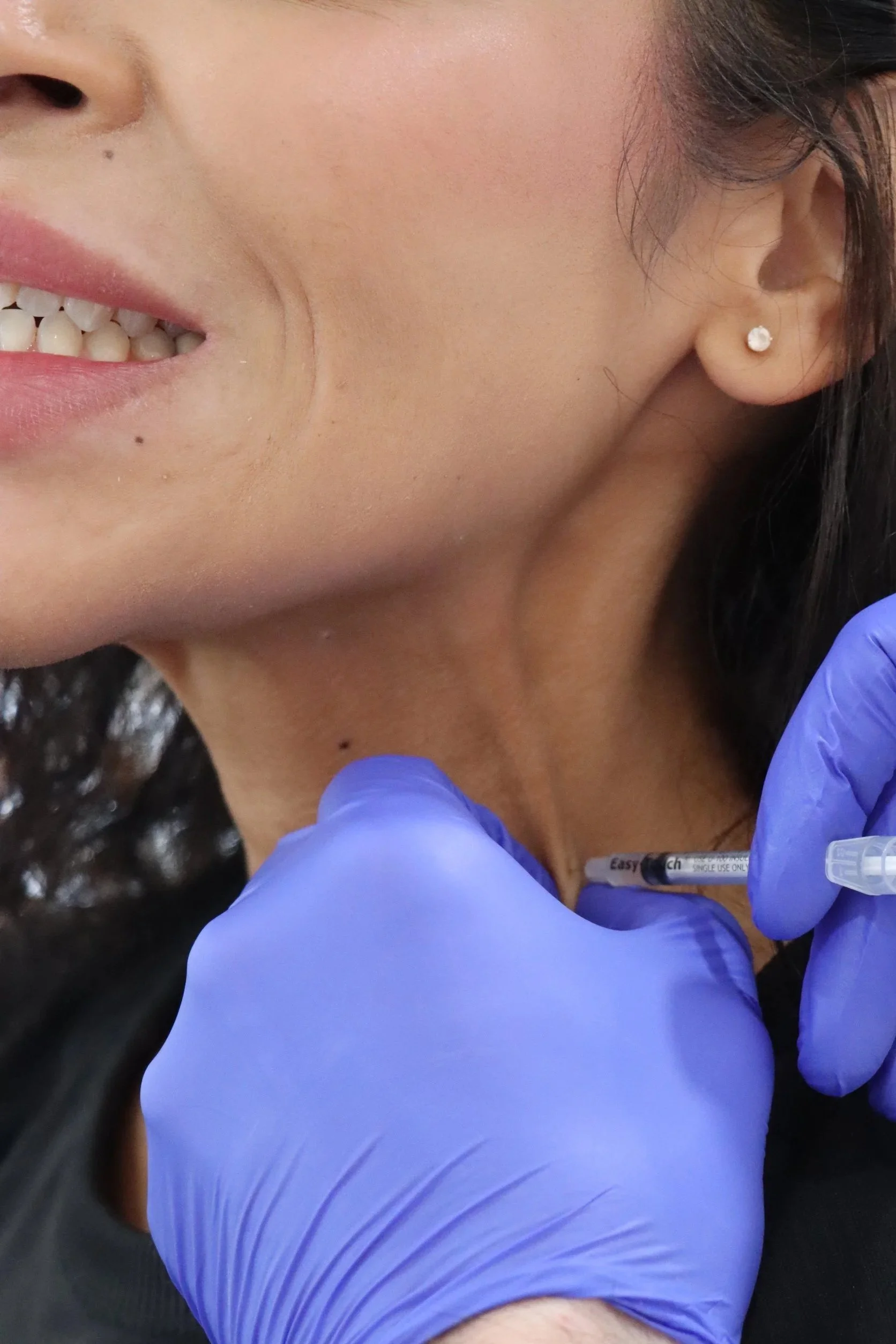 A person receiving botox in their neck, wearing a purple glove, with part of their face and ear visible.