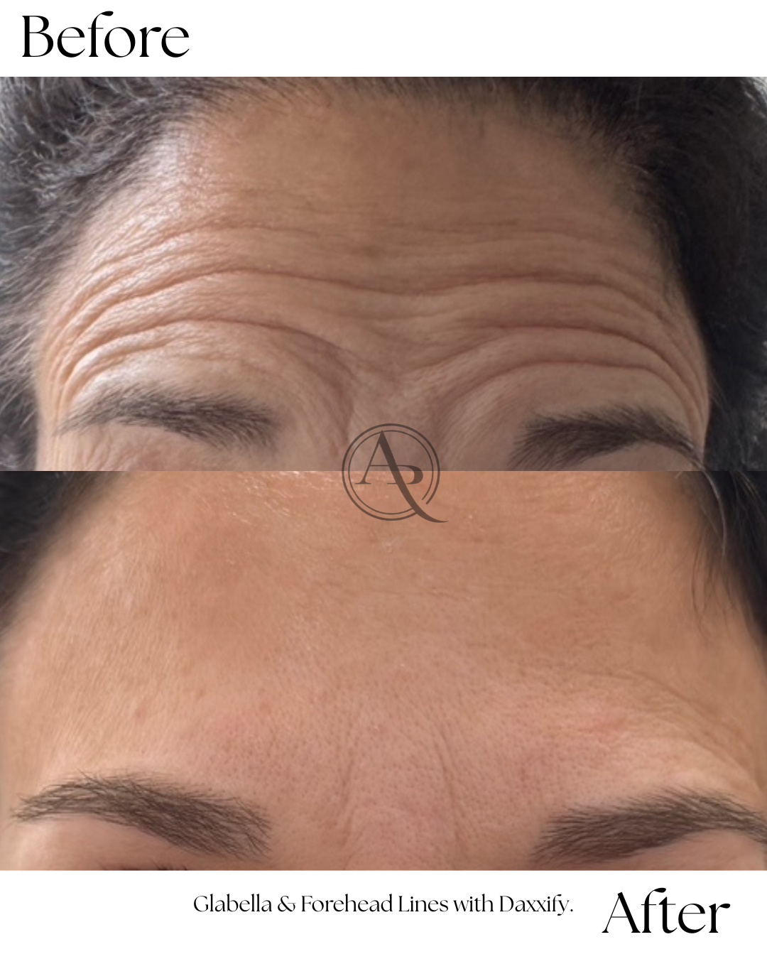 Wrinkle Relaxer