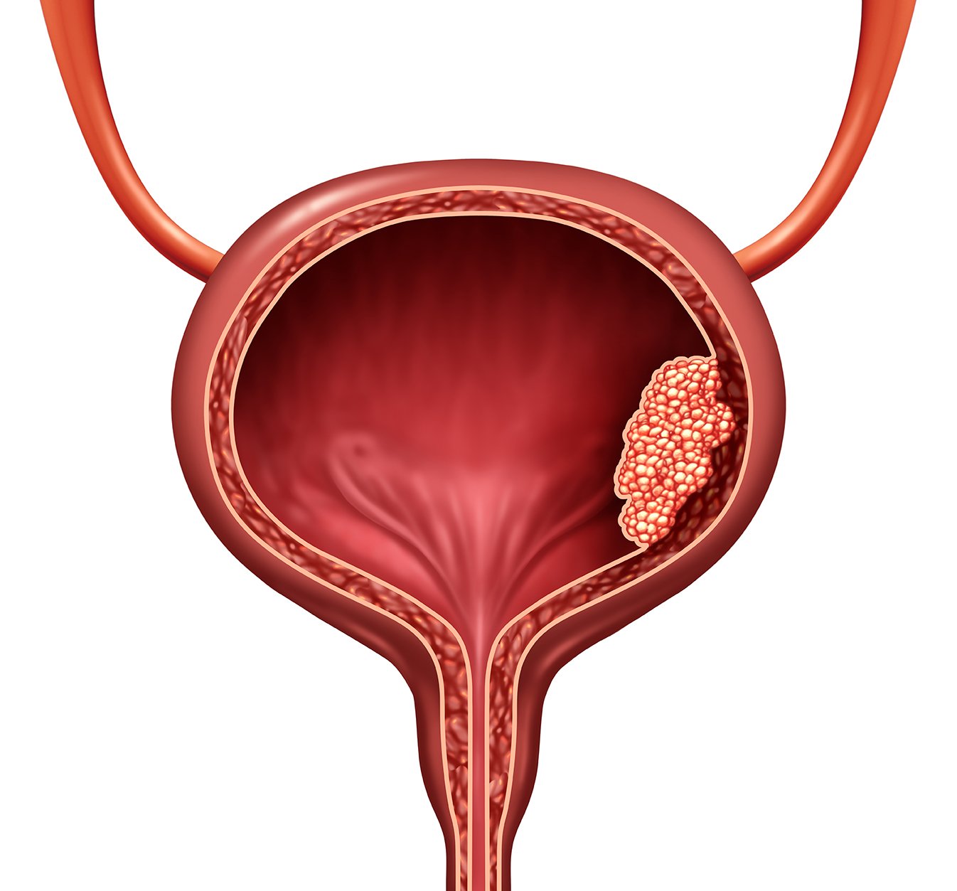 Restorative Urology Dr Marni Basto Urological Surgeon Sydney Urology Mona Vale St Leonards