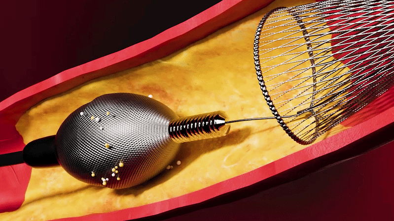 Visualizing the Procedure