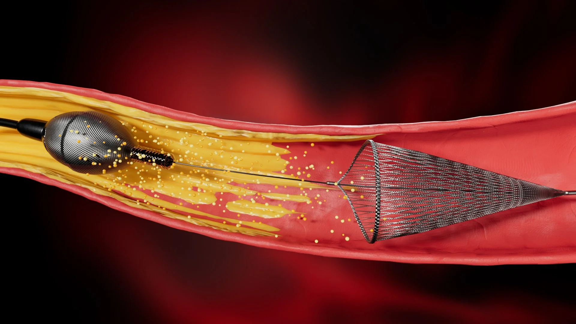 3D Modeling: Medical Procedure