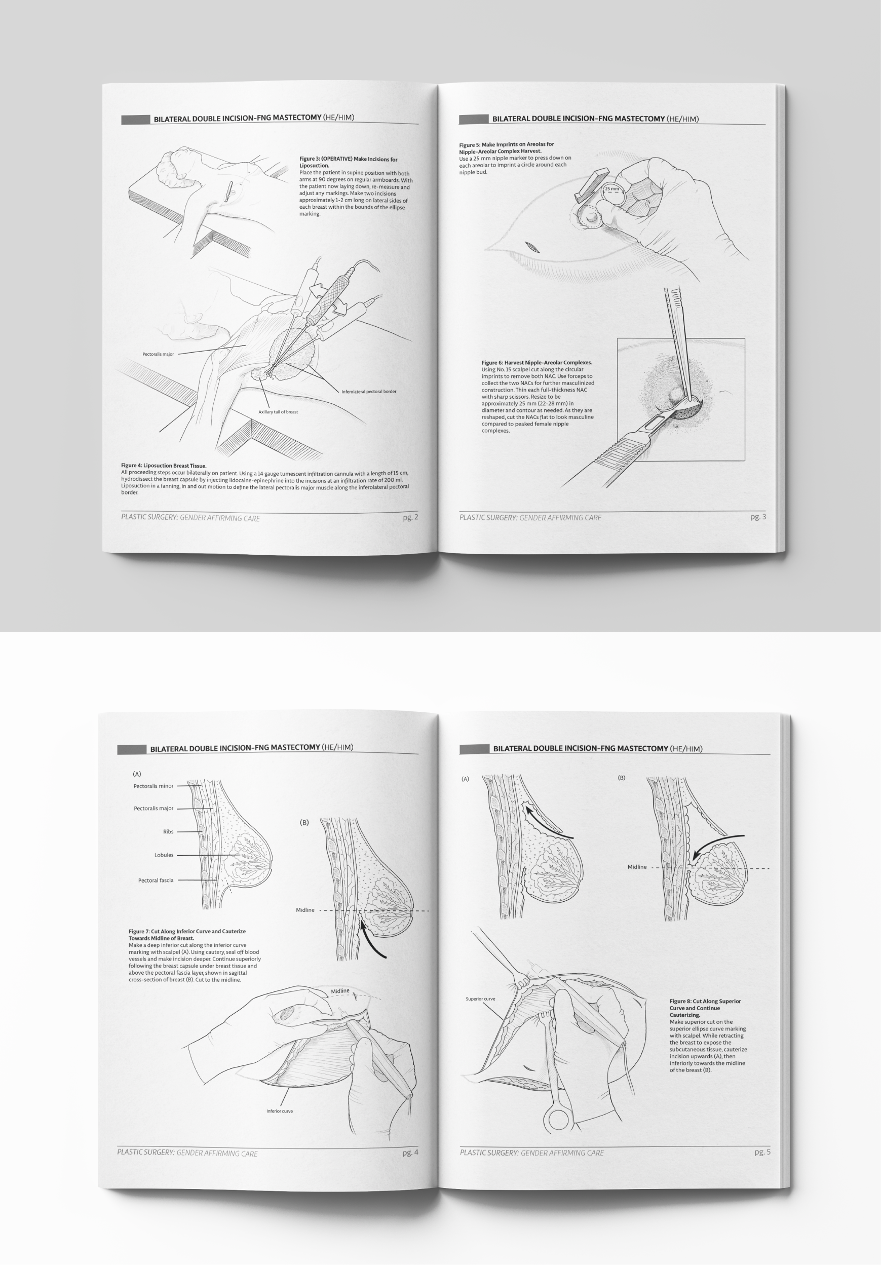 surgery_mockup.png