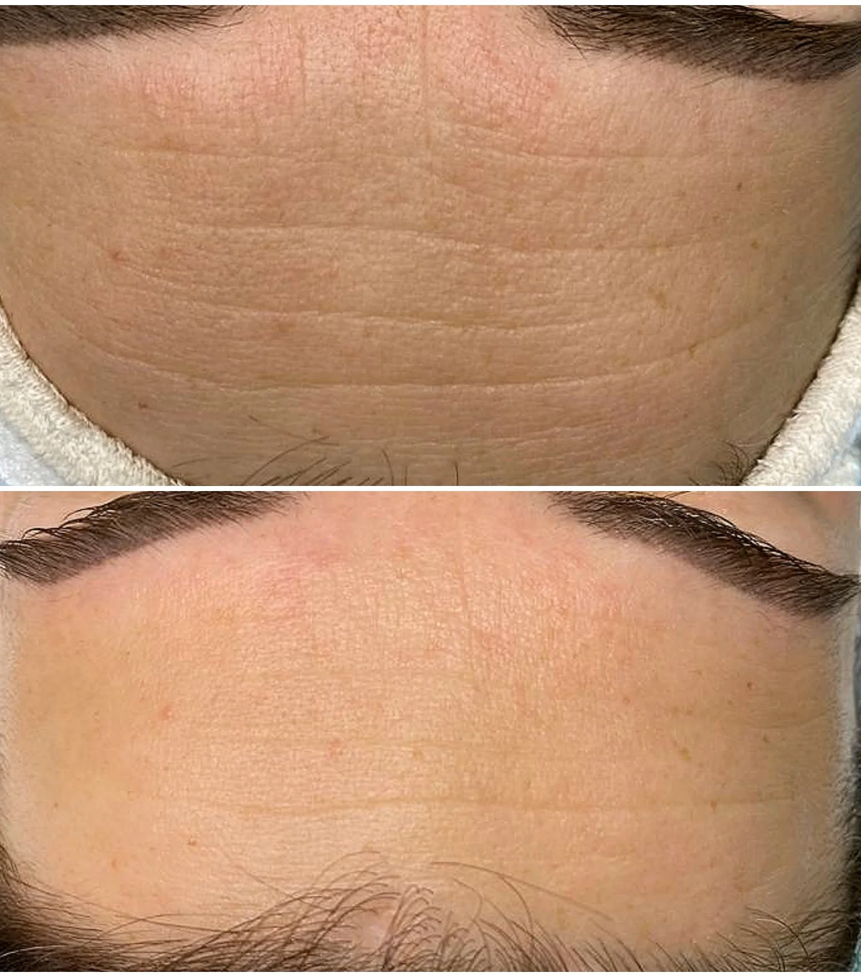 BEFORE AFTER 2.jpg