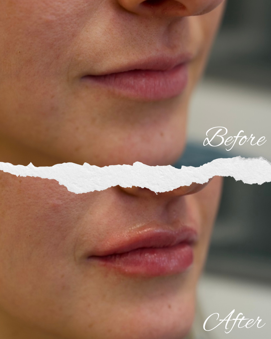 Copy of Before - 1.png