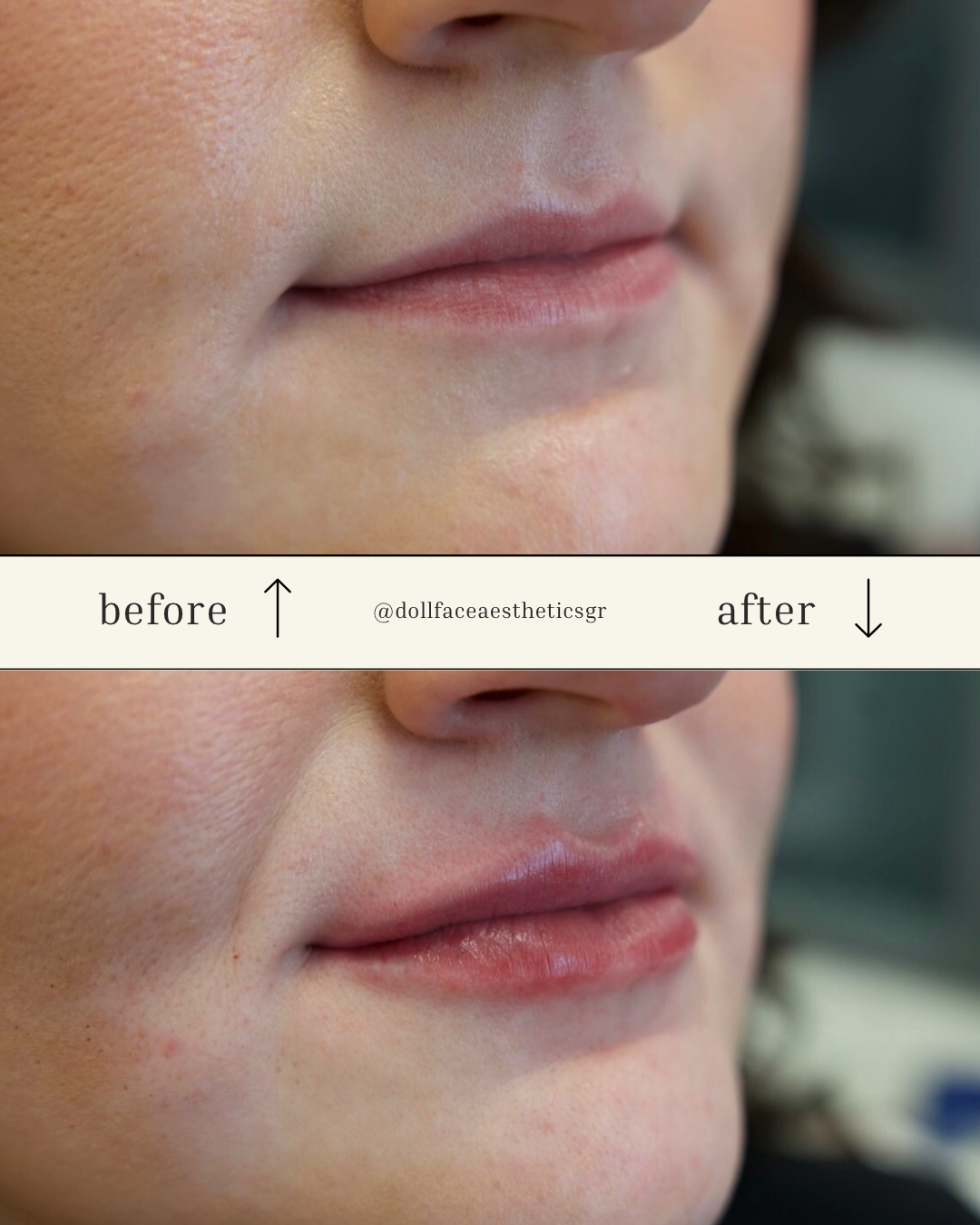 Copy of Copy of Copy of @dollfaceaestheticsgr.png