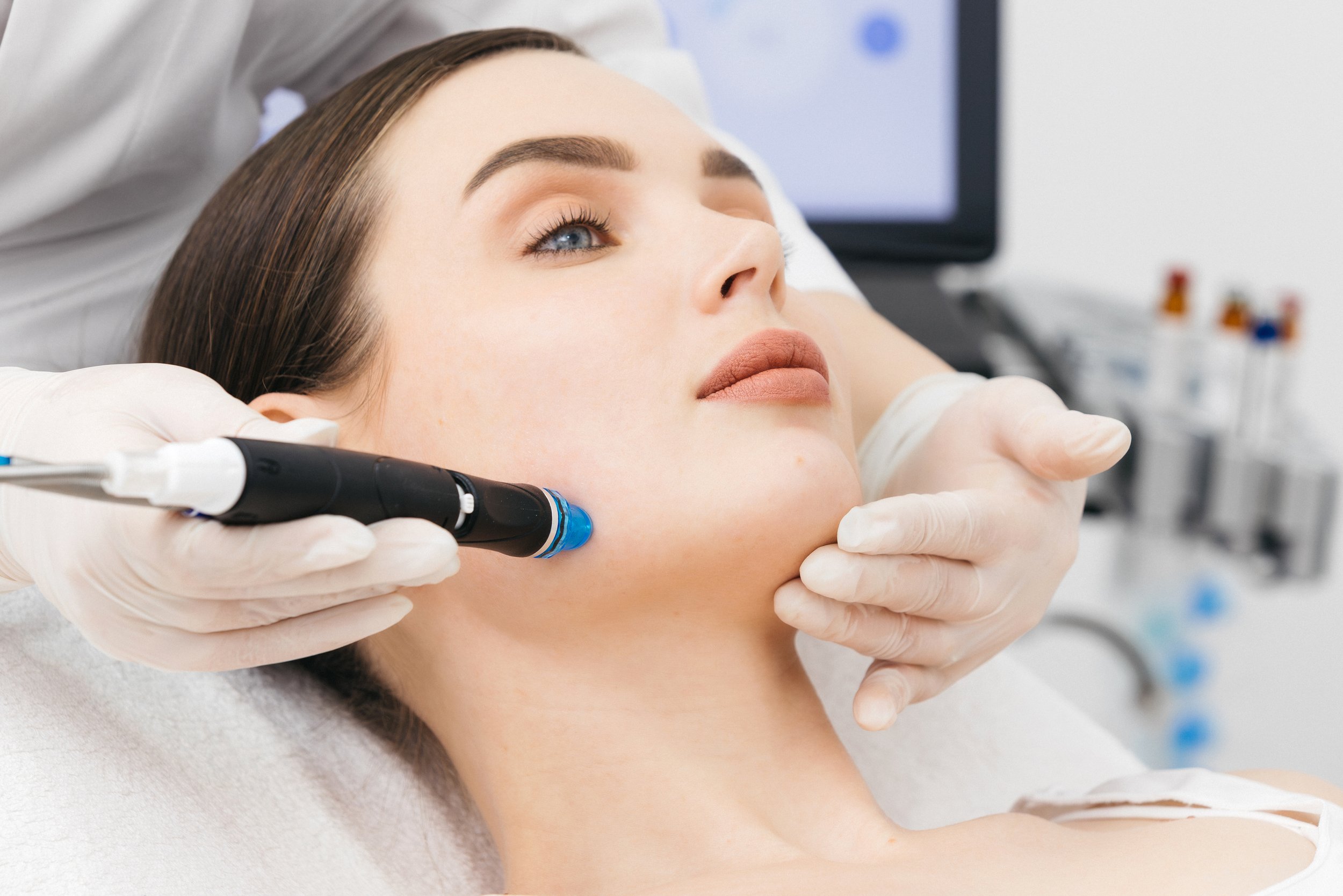 Microneedling in Grand Rapids , MI 49503  Doll Face Aesthetics Grand Rapids