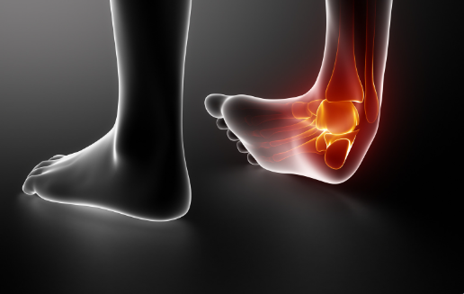 Why Your Ankle Keeps Rolling: Chronic Ankle Instability in Combat Sports