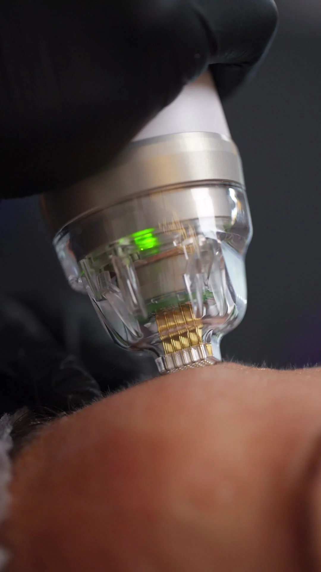 Discover the power of Microneedling ✨
This collagen-boosting treatment helps improve skin texture, reduce fine lines, acne scars, and reveal a smoother, firmer complexion over time. At Refined Radiance, we use advanced technology to deliver visible,