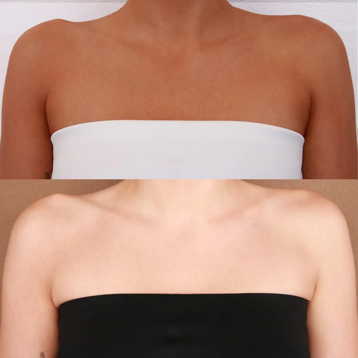 Comparison of upper torsos, top image shows tanned skin with a white strapless top, bottom image shows lighter skin with a black strapless top.