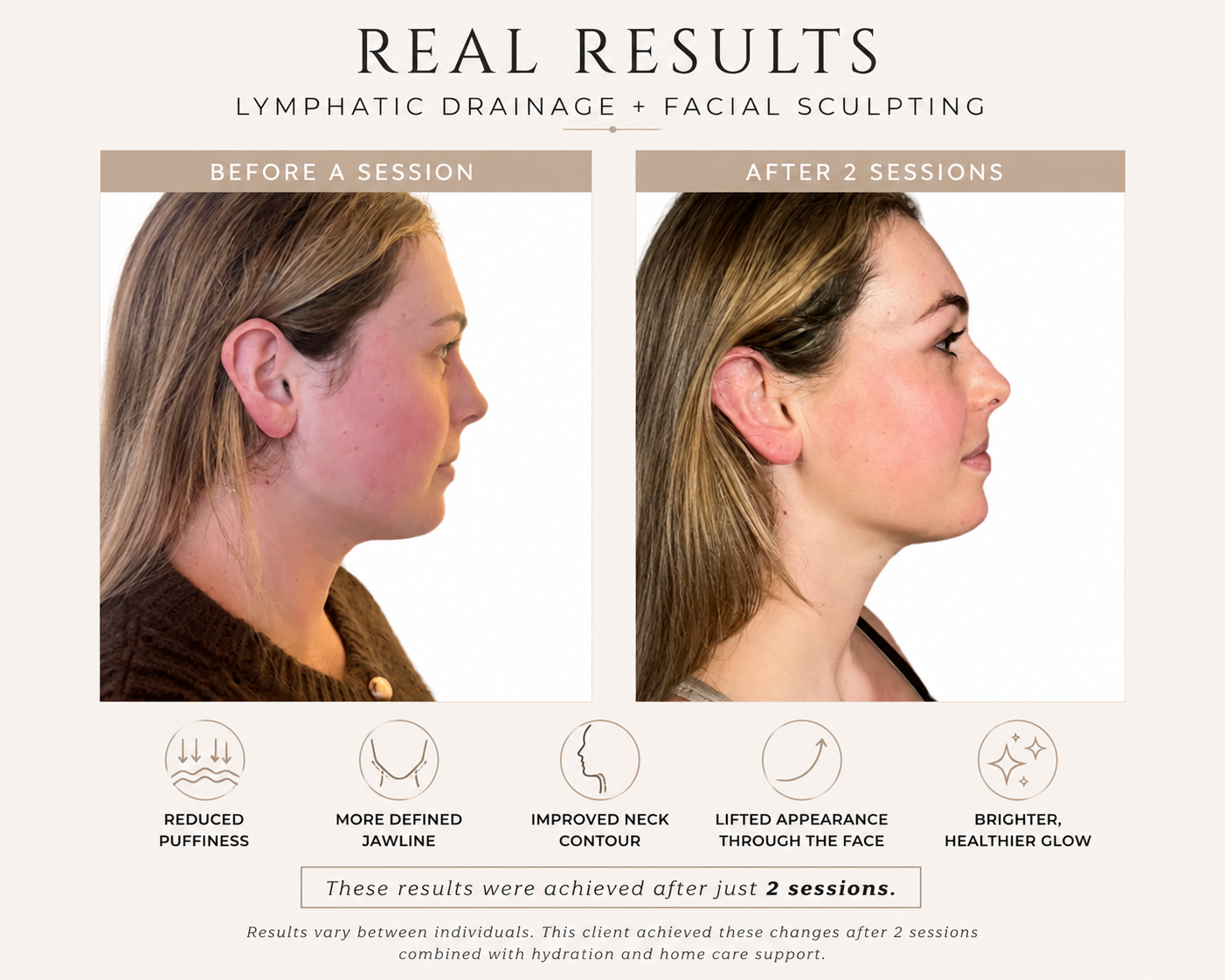 Comparison of a woman's profile before and after two sessions of lymphatic drainage and facial sculpting. The 'before' image shows a woman with a less defined jawline and slightly puffier face, while the 'after' image shows a more contoured neck and face with a healthier glow.