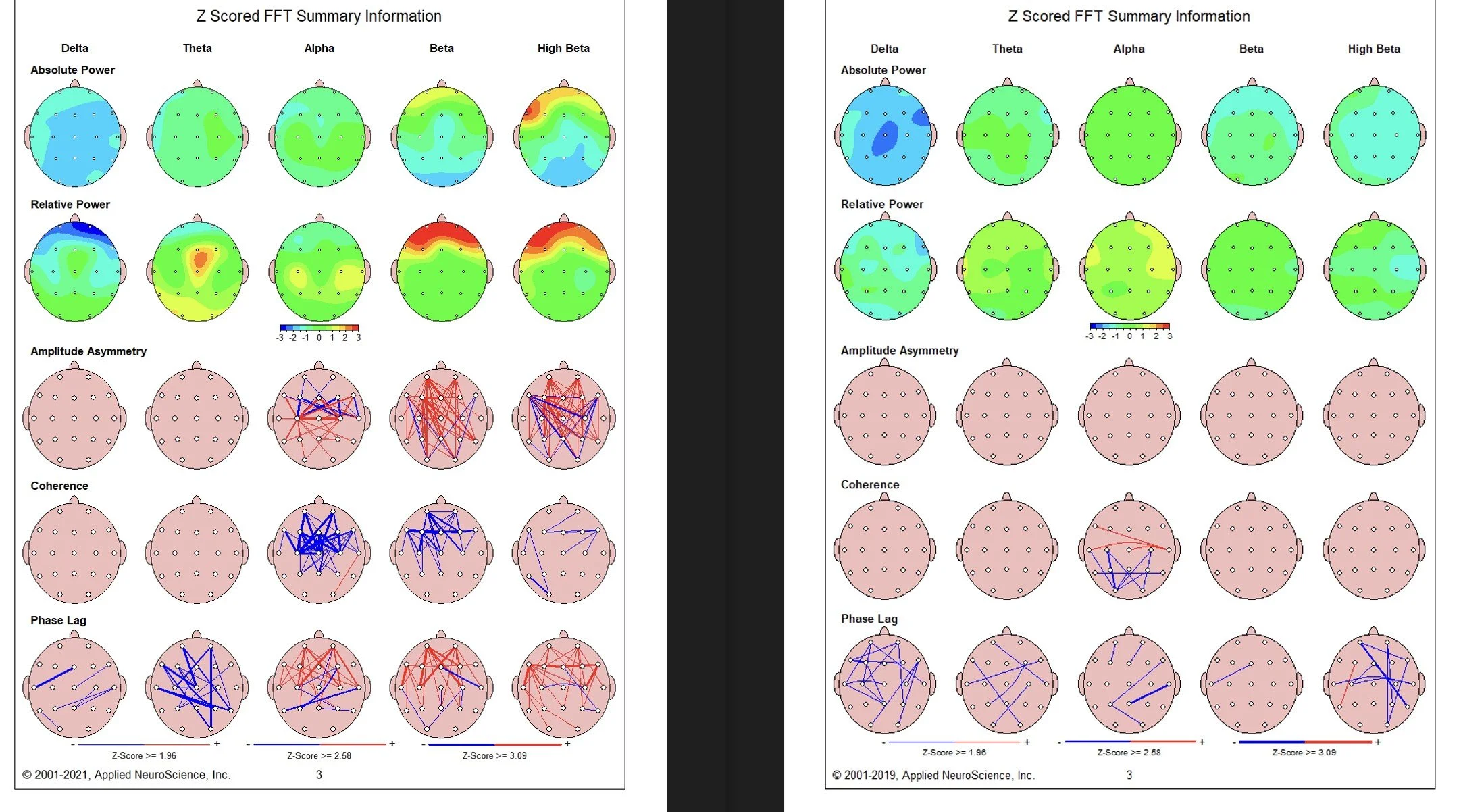 ADHD after neurofeedback