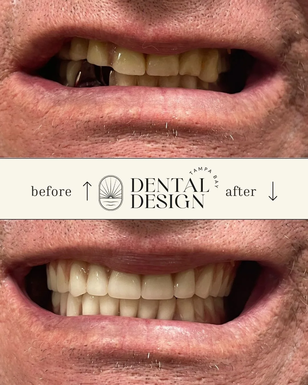 ✨ You can see the boost in his confidence from this smile alone! A healthy, beautiful smile can make all the difference &mdash; let us help you feel just as confident.