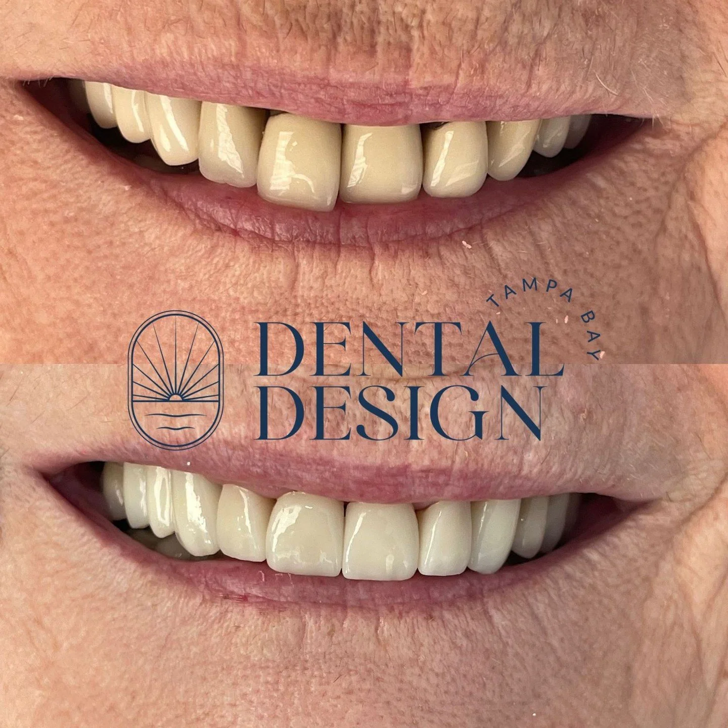 A confident smile changes everything 💫 See the difference? Your transformation could be next &mdash; call or DM us to start your smile journey!