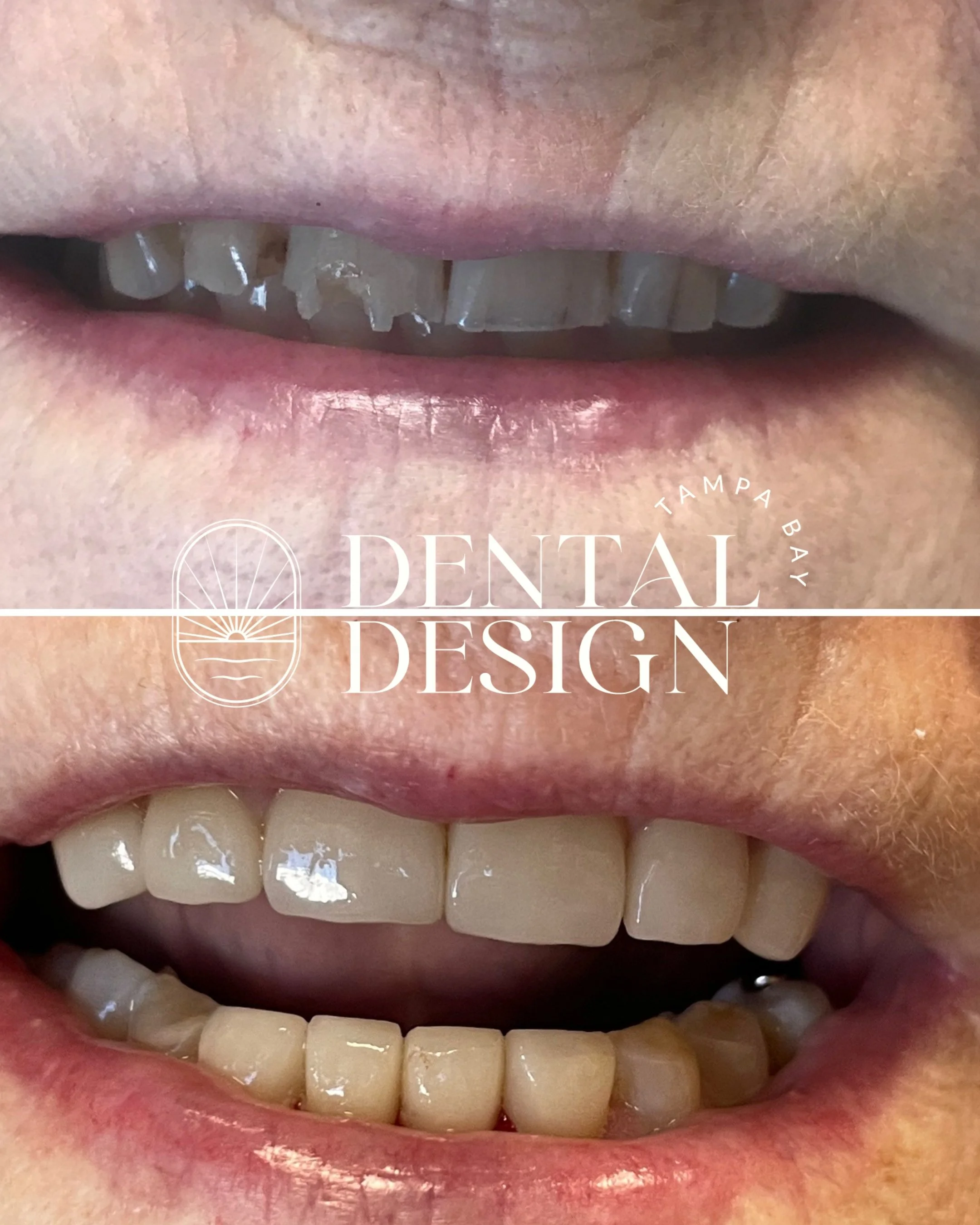 patient at the dentist; restorative dental care in tampa