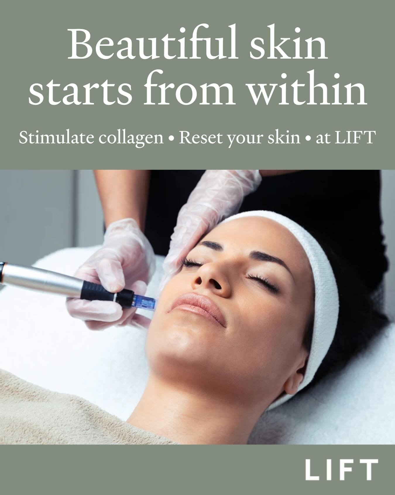 ✨ DERMAL NEEDLING ✨

Think of this as your skin&rsquo;s reset button. Dermal Needling (aka collagen induction therapy) is a powerhouse treatment that helps stimulate your skin&rsquo;s natural repair process. Boosting collagen, improving texture, and 