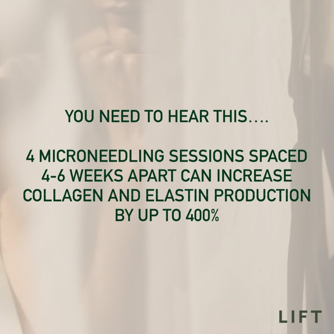 Microneedling is one of those treatments we recommend when you&rsquo;re ready to actually work on your skin. 

When it&rsquo;s done properly and in a series it supports collagen, smooths texture, and helps your skin feel stronger over time. 

Slow, i