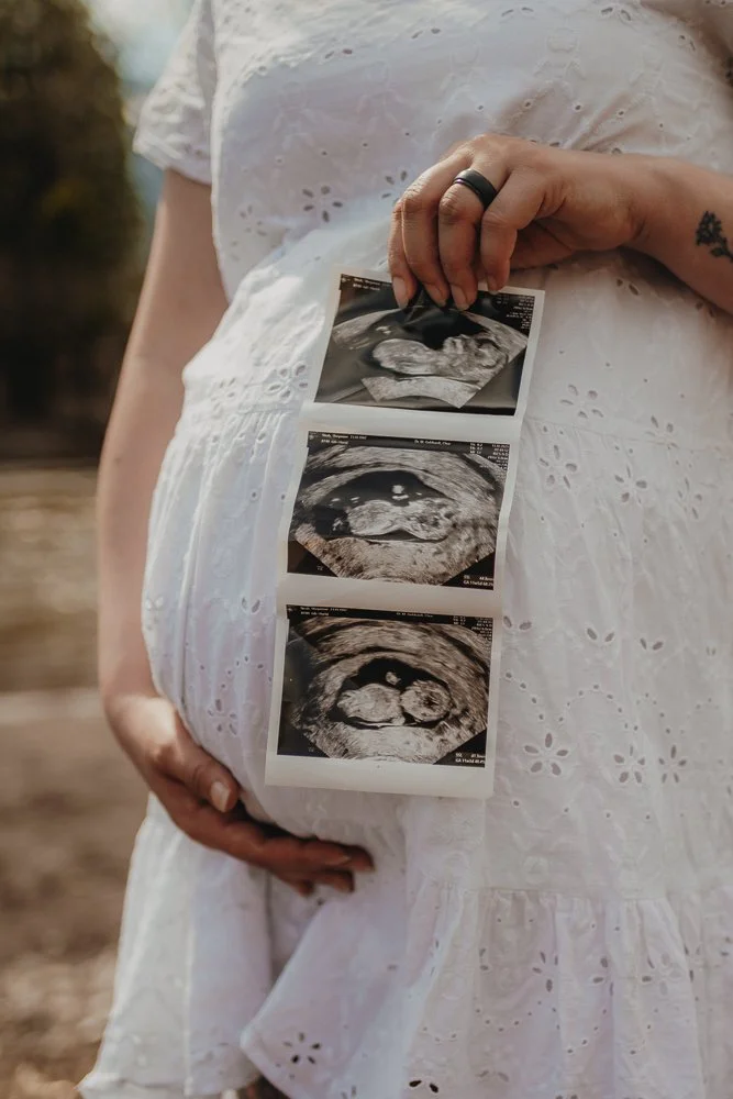 Schwangere Frau in weißem Kleid hält Ultraschallbilder ihres ungeborenen Babys vor ihrem Bauch.