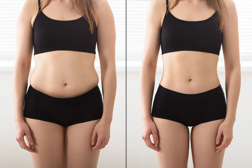body-sculpting-contouring-1024x683.jpg