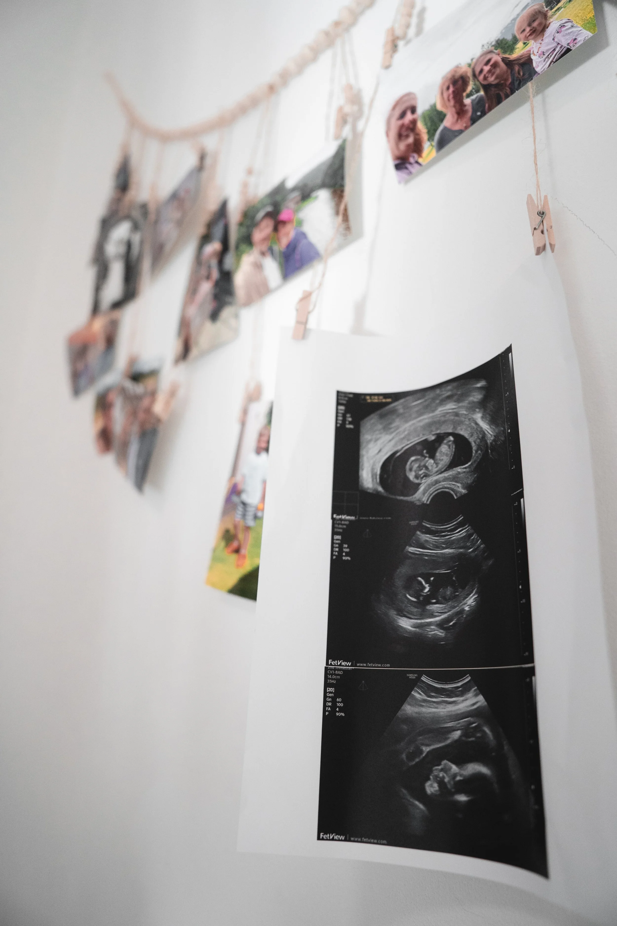 DSC01845-minKuba a Petra Jelínkovi těhotenské focení Dyguen.jpg