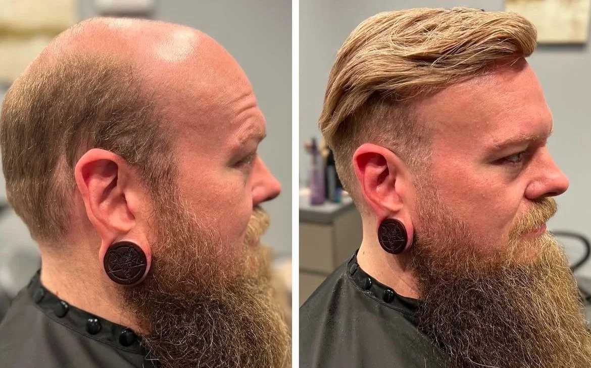 Before and after hair transformation of a man with ear gauges, showing bald to styled hair.