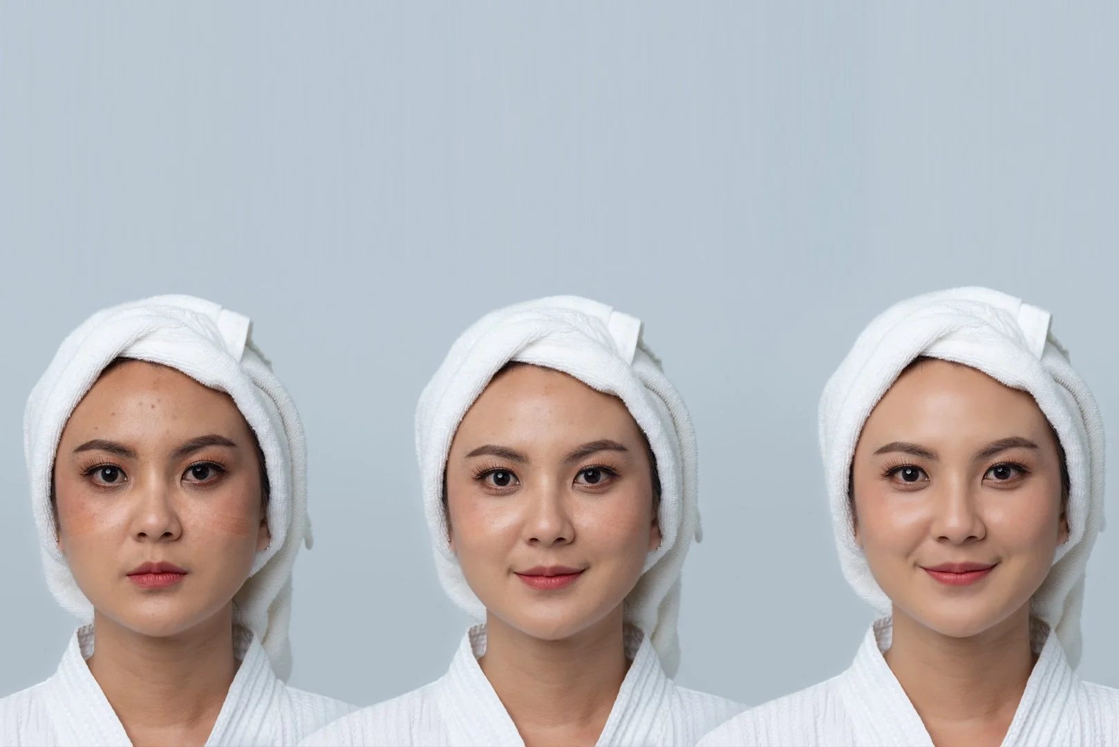 Why Fall Is the Perfect Time to Treat Dark Spots