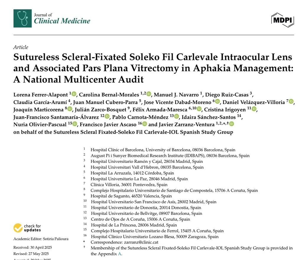 Sutureless Scleral-Fixated Carlevale IOL + Pars Plana Vitrectomy in Aphakia: Real-World Audit 💻

We are glad to present a national, multicenter retrospective audit of 268 eyes undergoing simultaneous pars plana vitrectomy (PPV) and sutureless sclera