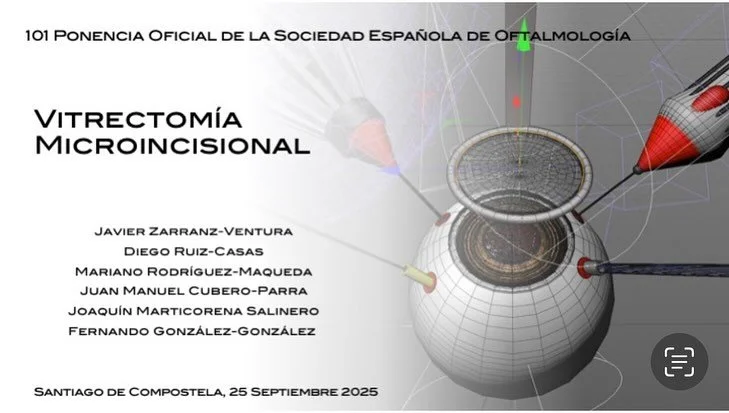 Hoy presentamos la Ponencia Oficial 2025 de la @sociedadespanolaoftalmologia en Santiago de Compostela, sobre &ldquo;Vitrectomia Microincisional&rdquo;.

Este trabajo ha sido realizado
- 6 editores
- 154 autores
- 21 bloques
- 177 v&iacute;deos quir&