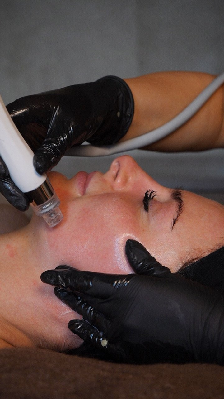 A person receiving a facial treatment with a cosmetic device, lying down with eyes closed, while a practitioner in black gloves performs the procedure.