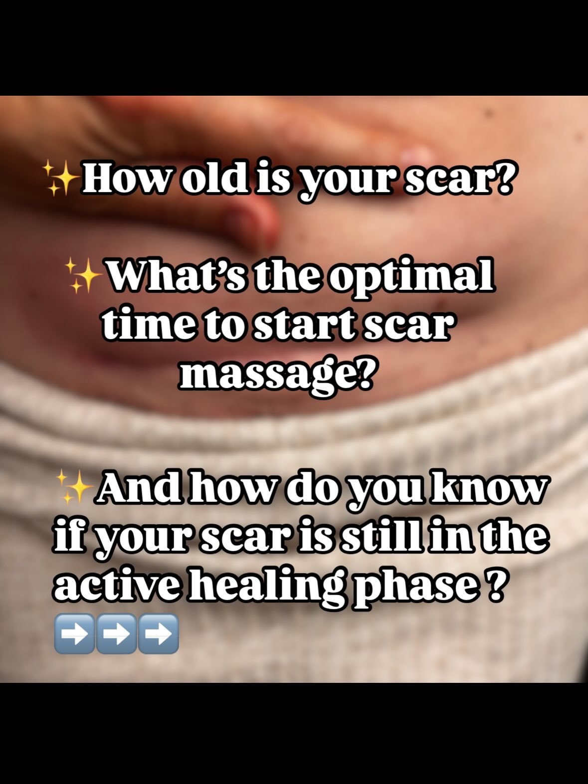 🤍How old is your Scar ? 

🤍When is it optimal to start with your scar massage ? 

🤍And how do you know if your scar is still in the active healing phase? 

Like ❤️the post if you found it helpful and share with a fellow c-section mamma friend! 

F