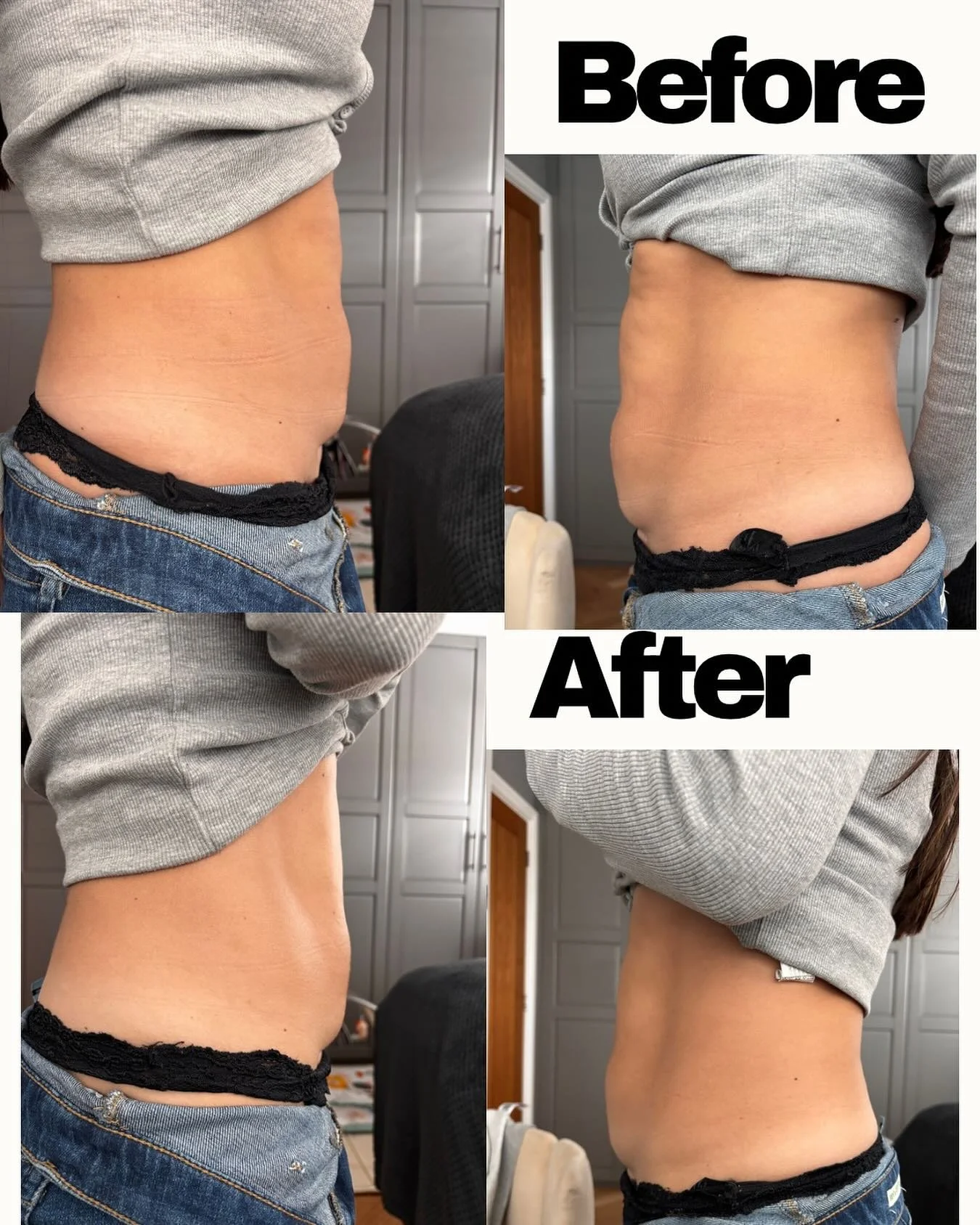✨ The transformation pictures keep coming! ✨

Another amazing mamma&rsquo;s journey &mdash; just look at the difference from her very first session with me! 💕

I absolutely love seeing these results and celebrating the progress of my lovely mums. Th
