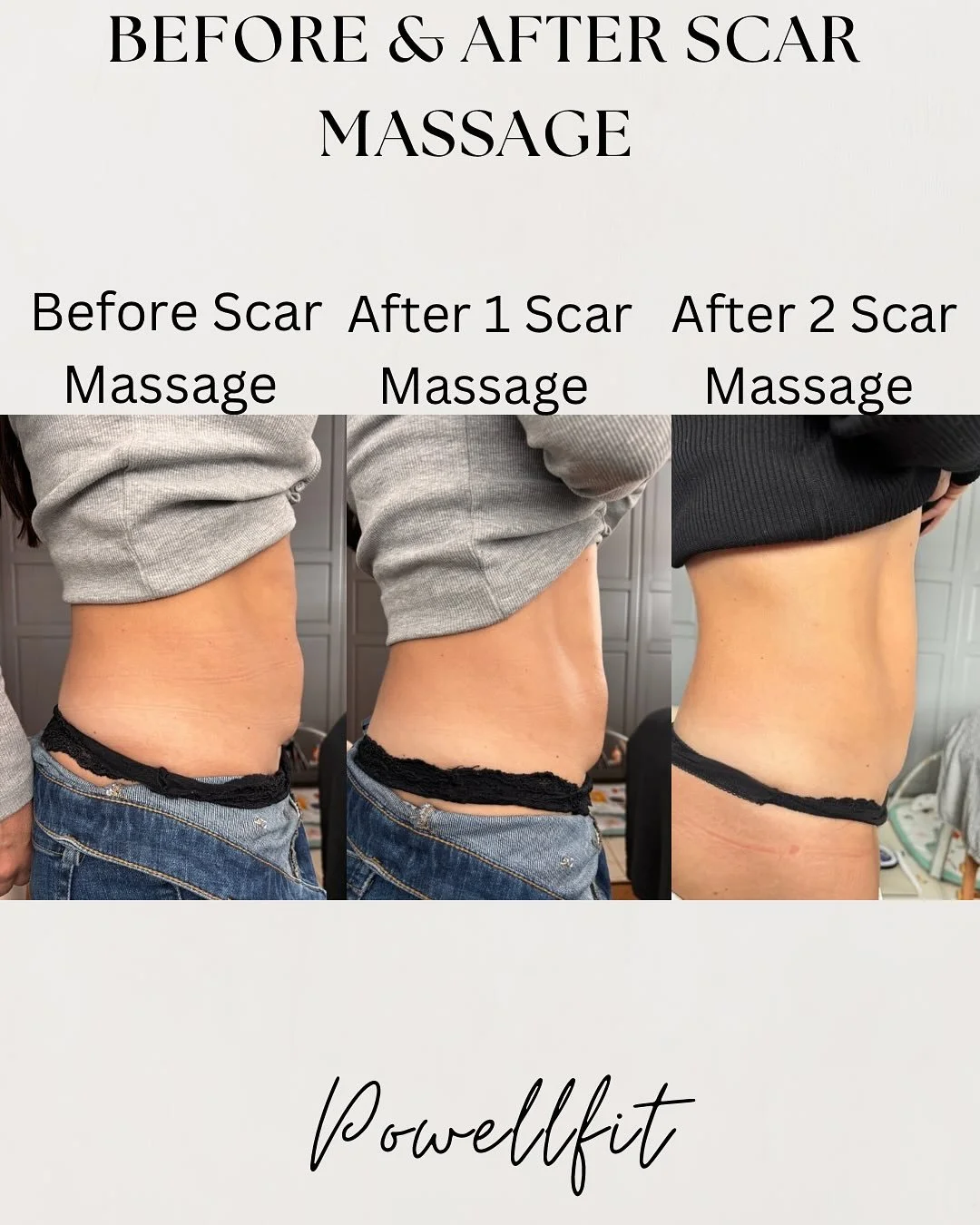 ✨ I can&rsquo;t even begin to say how happy I am for my lovely client and mamma who&rsquo;s just had her second session with me! ✨

If you&rsquo;re struggling with a shelf (overhang), please know there are things we can do! 💪

This amazing mamma cam