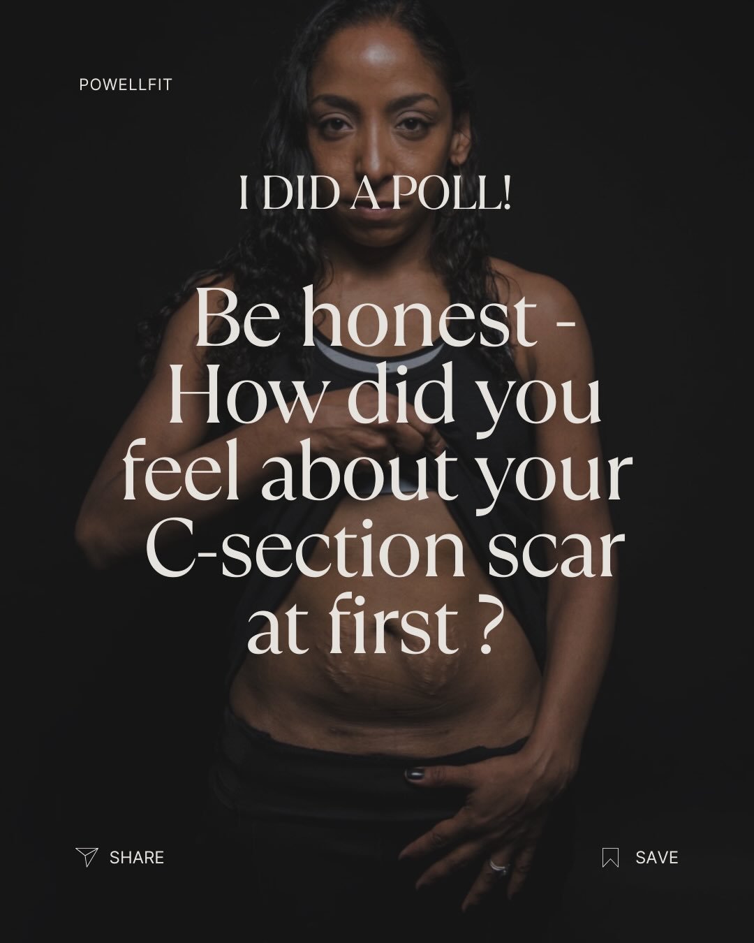 POLL VOTES 👇🏻 

I asked my mums something honest&hellip;

BE HONEST &mdash; How did you feel about your scar at first?

⬇️ The answers stopped me in my tracks&hellip;

42% &mdash; AVOIDED looking at it
27% &mdash; STRUGGLED with it
21% &mdash; Didn