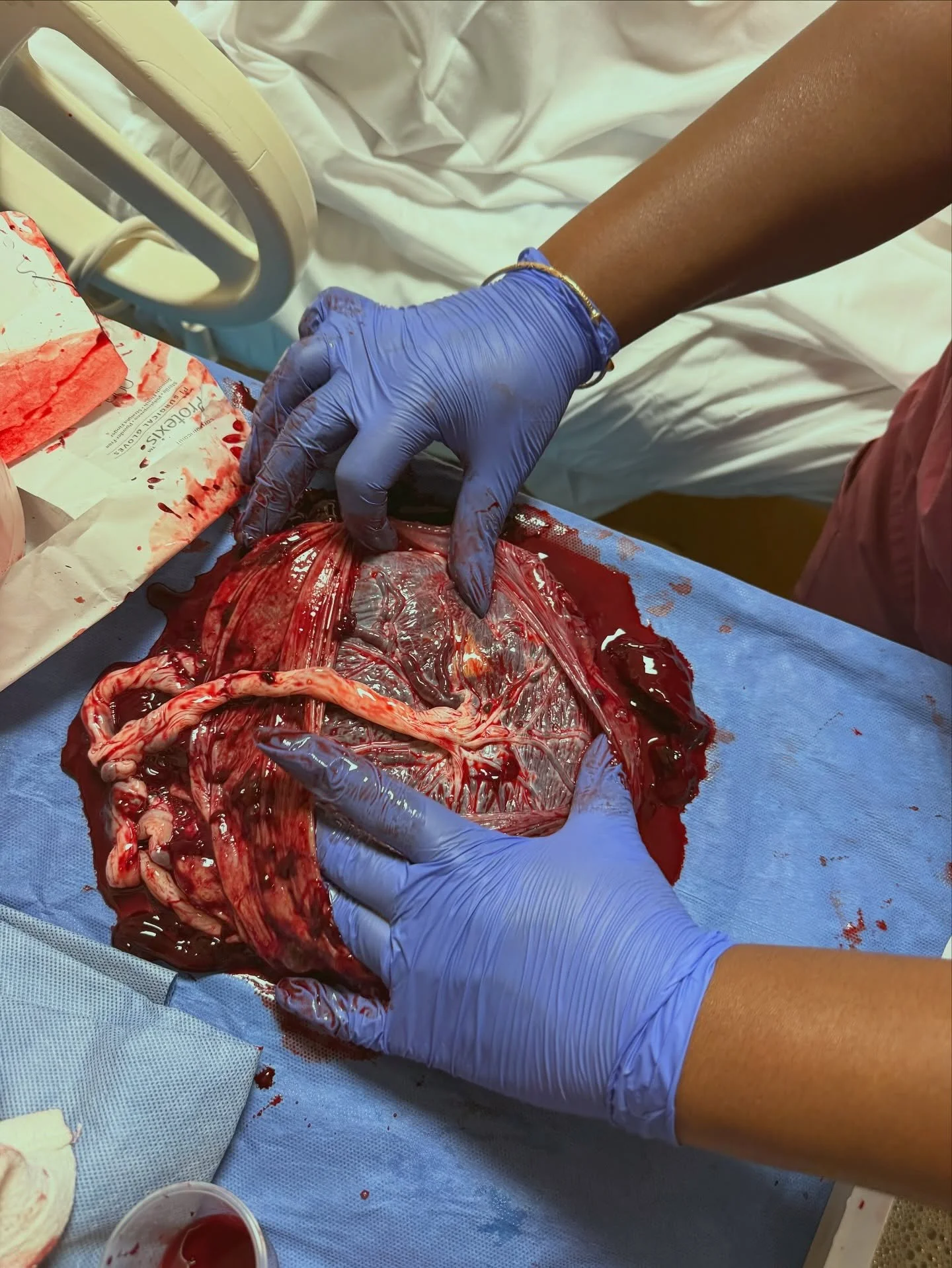 A placenta tour! Did you know you can ask to see your placenta before the hospital disposes of it? You can explore the maternal side, fetal side, umbilical cord and stretch of blood vessels called the &ldquo;tree of life.&rdquo; You also have options