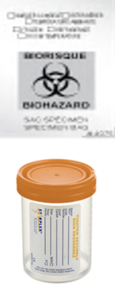 Une boîte de prélèvement biologique avec un couvercle orange, utilisée pour l'échantillonnage de laboratoire, et un symbole de biohazard avec un texte en anglais, indiquant une matière potentiellement dangereuse biologique.