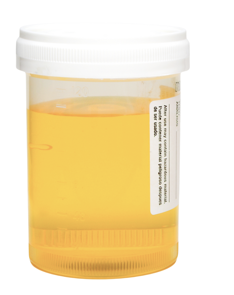 Conteneur de médicament avec un liquide jaune clair.