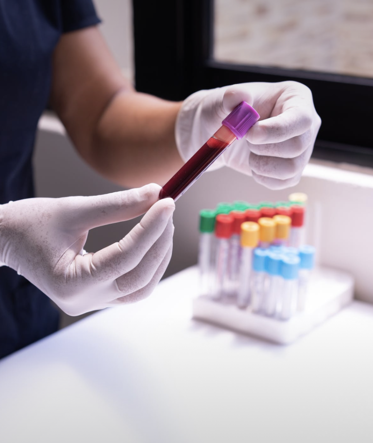 Personne tenant un tube de prélèvement sanguin avec du sang rouge à l'intérieur, portant des gants en latex blancs, dans un laboratoire.