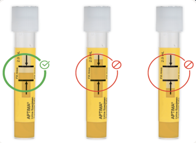 Trois tubes de prélèvement sanguin avec différents niveaux de remplissage, montrant la bonne, la mauvaise et la mauvaise manière de remplir un tube de prélèvement.