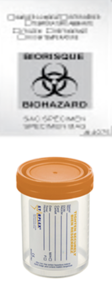 Une bouteille à prélèvement stérile à large ouverture avec un couvercle orange et une fiche d'identification. En arrière-plan, un document affichant un symbole de biohazard et des mentions de danger biologique.