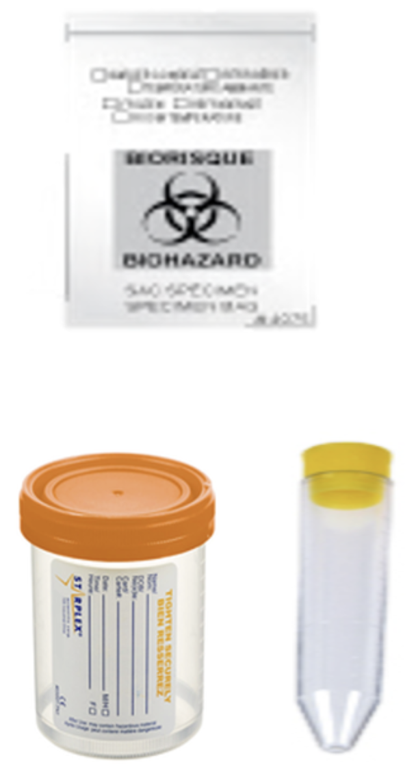 Conteneur de collecte d'échantillons biologiques avec une étiquette indiquant un danger biologique, un contenant en plastique avec un couvercle orange, et un tube à essai avec un capuchon jaune.