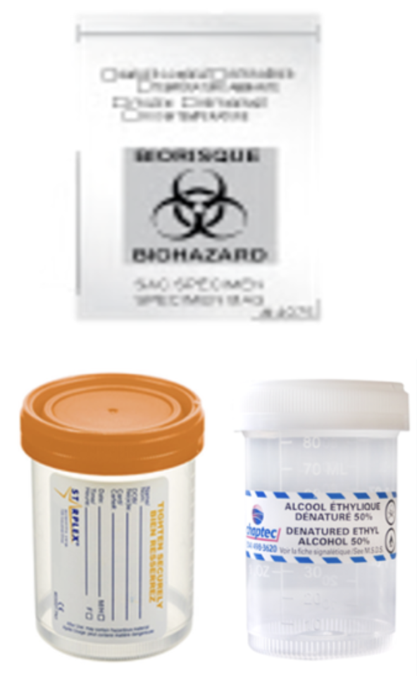 Articles médicaux et un récipient de désinfectant pour les mains avec un symbole de biohazard indiquant un danger biologique.