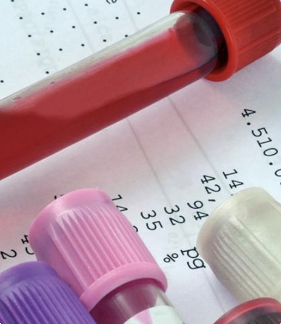 Vials de tubes à essai de différentes couleurs (violet, rose, blanc et rouge) posés sur un document avec des dessins techniques ou des instructions écrites.