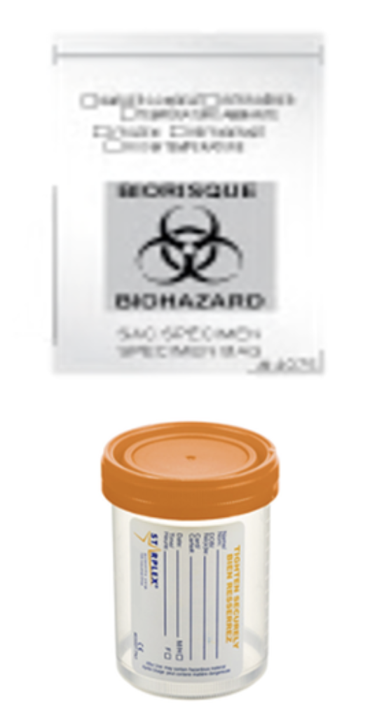 Image d'un conteneur de test de biomarqueur et une fiche de laboratoire en arrière-plan avec un symbole de biohazard.