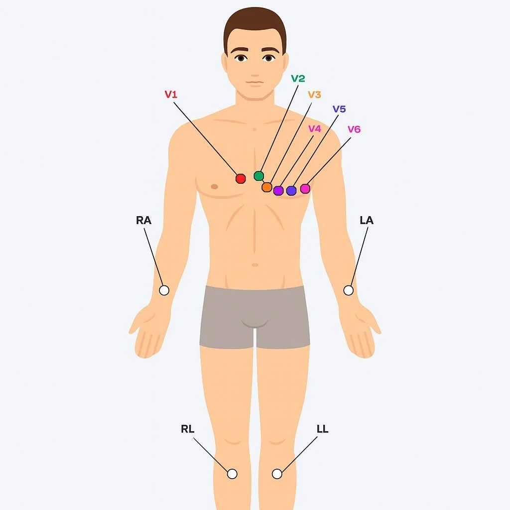 #EMSLife
#EMT
#Paramedic
#EMR
#FirstResponder
#PreHospitalCare
#SavingLives
#MedicMindset
#EMSStrong
#AmbulanceLife
#FieldMedicine