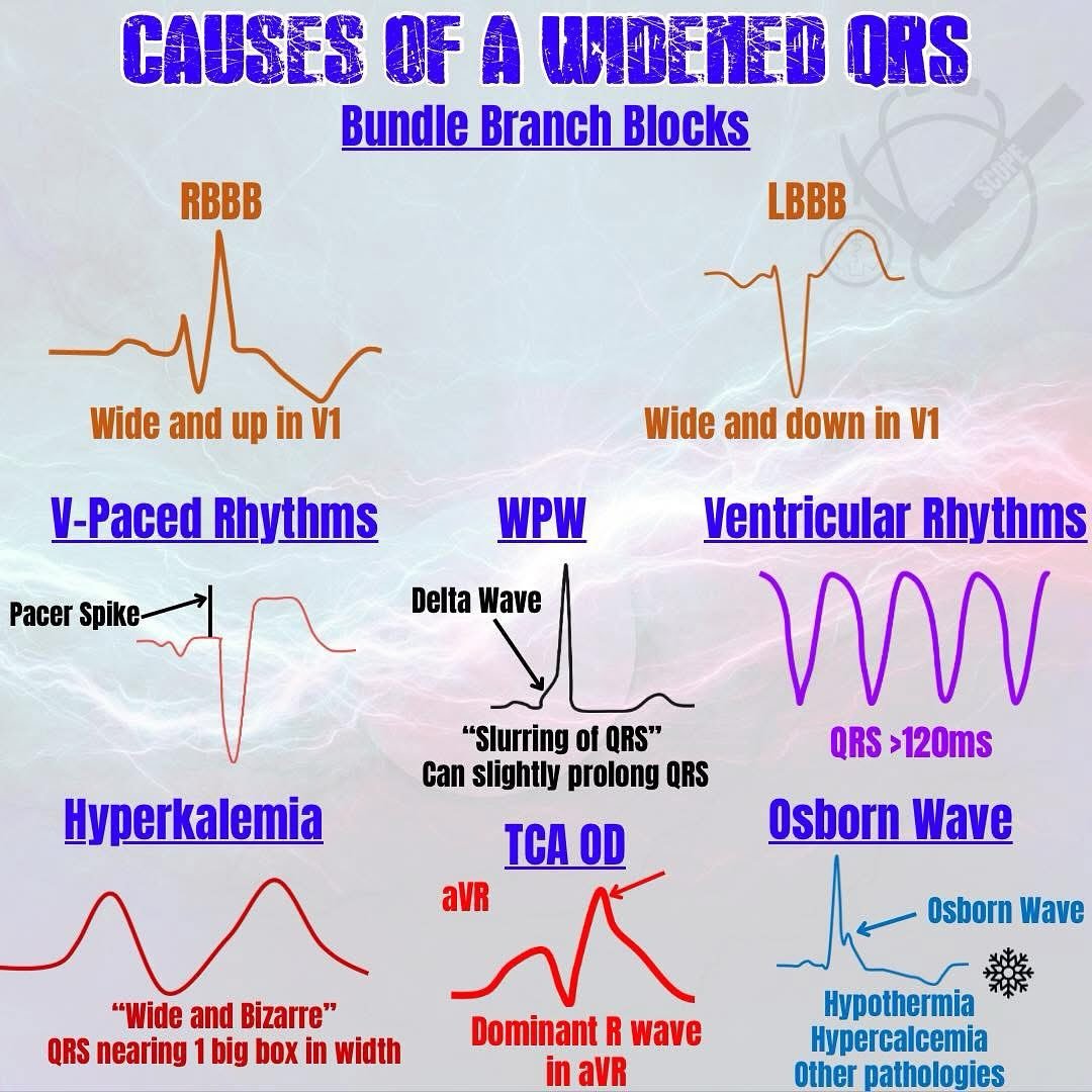 #EMSLife
#EMT
#Paramedic
#EMR
#FirstResponder
#PreHospitalCare
#SavingLives
#MedicMindset
#EMSStrong
#AmbulanceLife
#FieldMedicine