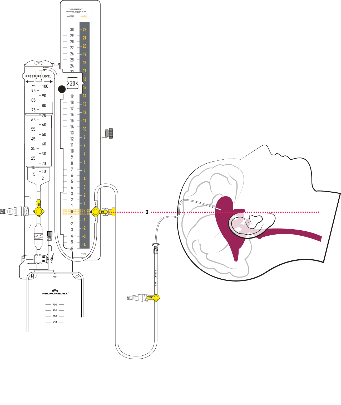 VentrEX® Complete technical view
