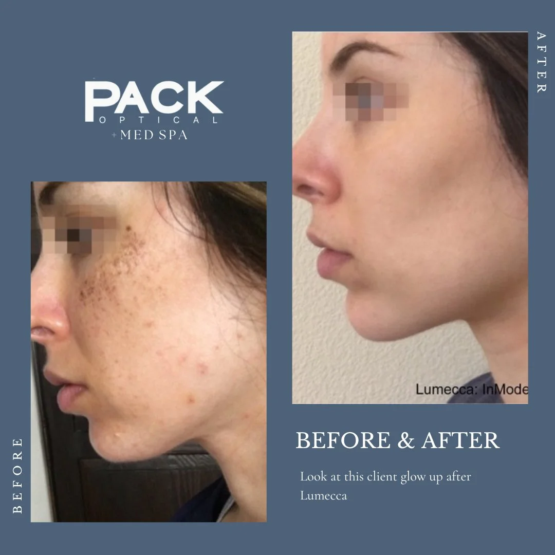 Lumecca-Before-and-after.jpg