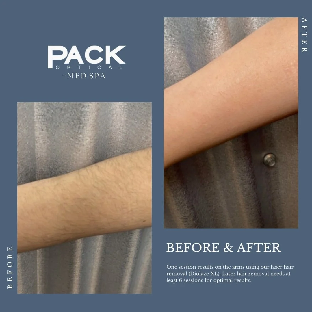 packoptical-aesthetics-before-and-after-1.jpg